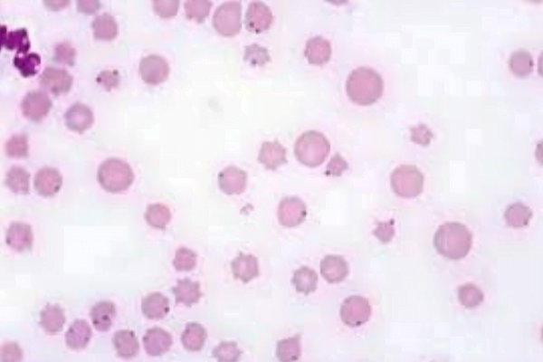 Anaplasmose Bovina 2vettop% Anaplasmose