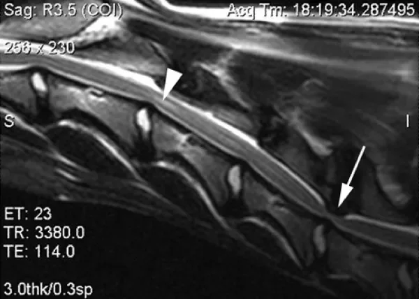 Síndrome de Wobbler em Cães: Compreensão e Diagnóstico 1vettop% sindrome de wobbler