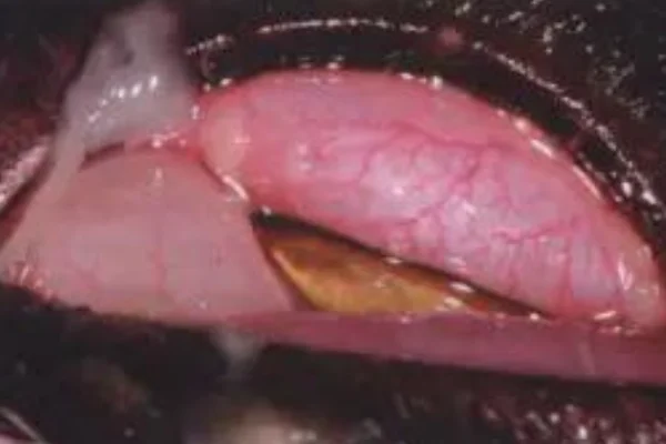 Clamidiose Felina: Contágio, Sintomas e Tratamento 2vettop% Clamidiose Felina (2)