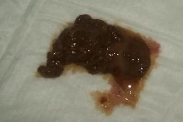 Fezes de cachorro com gosma; Oque fazer. 1vettop% Fezes de cachorro com gosma
