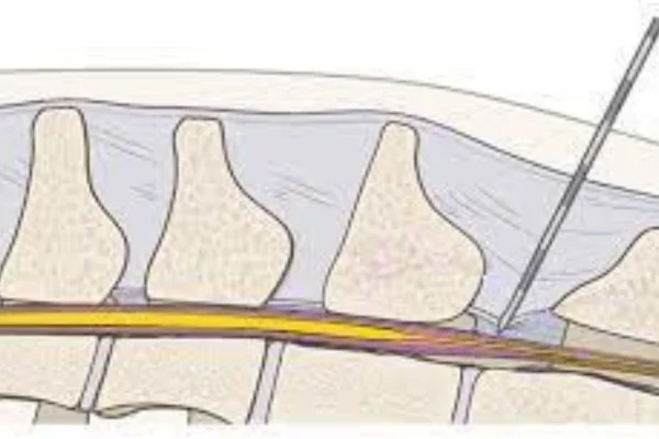Anestesia Epidural em Cães 1vettop% Anestesia Epidural em Cães (1)