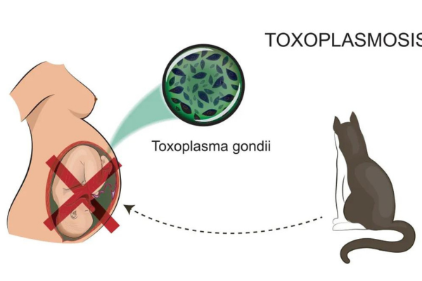 Toxoplasmose e Gravidez 1vettop% Toxoplasmose e Gravidez