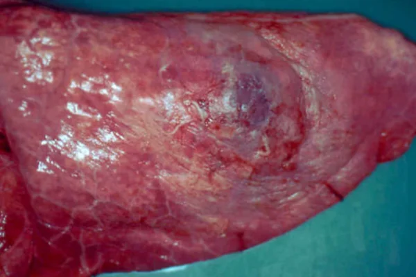 Actinobacilose Pleuropneumônica (APP) 1vettop% Actinobacilose Pleuropneumônica