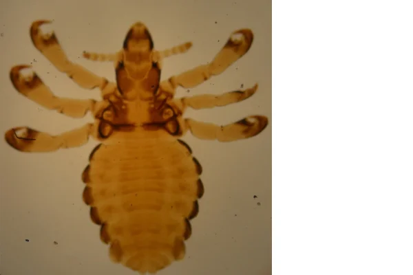 Pediculose (Haematopinus suis) 2vettop% Pediculose (Haematopinus suis) (1) (1)