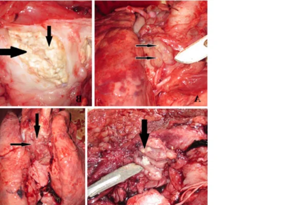 Tuberculose Suína 2vettop% Tuberculose Suína