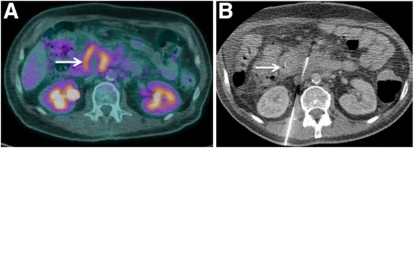 Carcinoma Pancreático em Cães 1vettop% Carcinoma pancreático em Cães