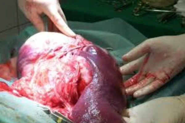 Hemangiossarcoma em Cães: 2vettop% hemangiossarcoma