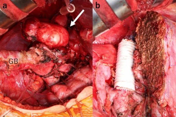 Leiomiossarcoma em Cães 1vettop% Leiomiossarcoma em Cães