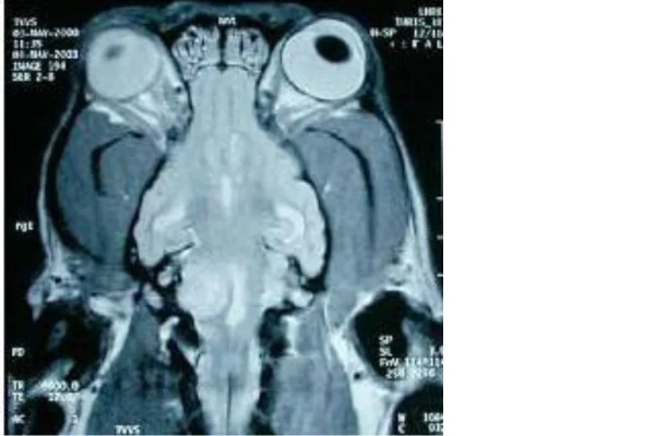 Tumores Cerebrais em Cães 2vettop% Tumores Cerebrais em Cães