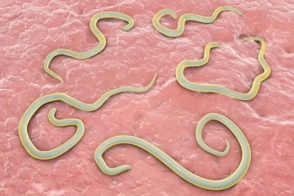 Entendendo a Toxocaríase 2vettop% Toxocaríase